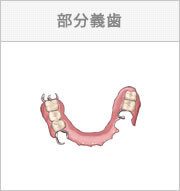 部分義歯